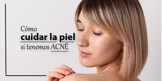 Cómo cuidar la piel si tenemos acné